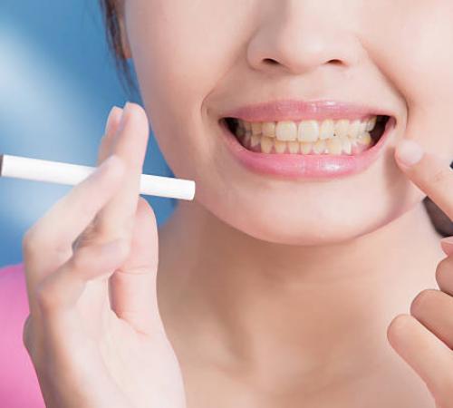 Tobacco & Oral Health